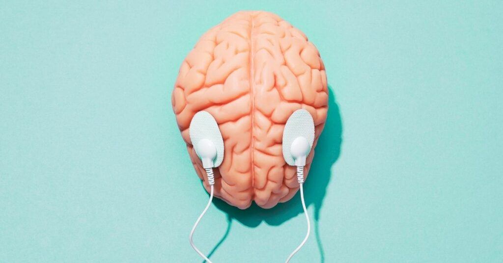 An electroconvulsive therapy (ECT) concept featuring a brain.